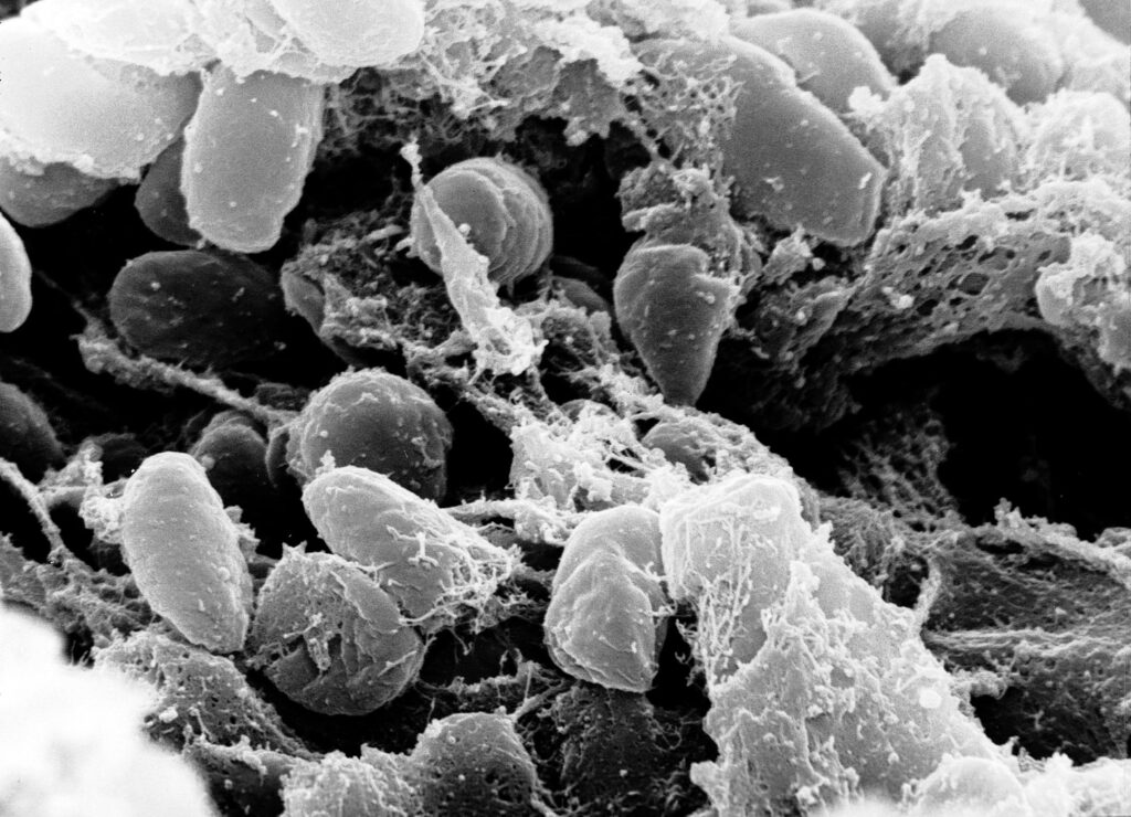 Incydent w laboratorium w Irkucku: Czy dżuma stanowi realne zagrożenie? Incydent w laboratorium w Irkucku: Czy dżuma stanowi realne zagrożenie?